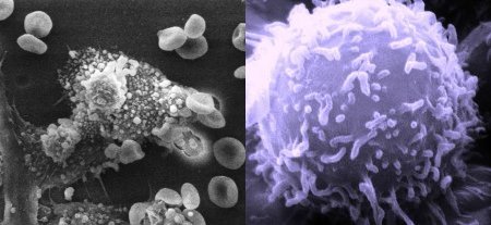 macrófago y linfocito